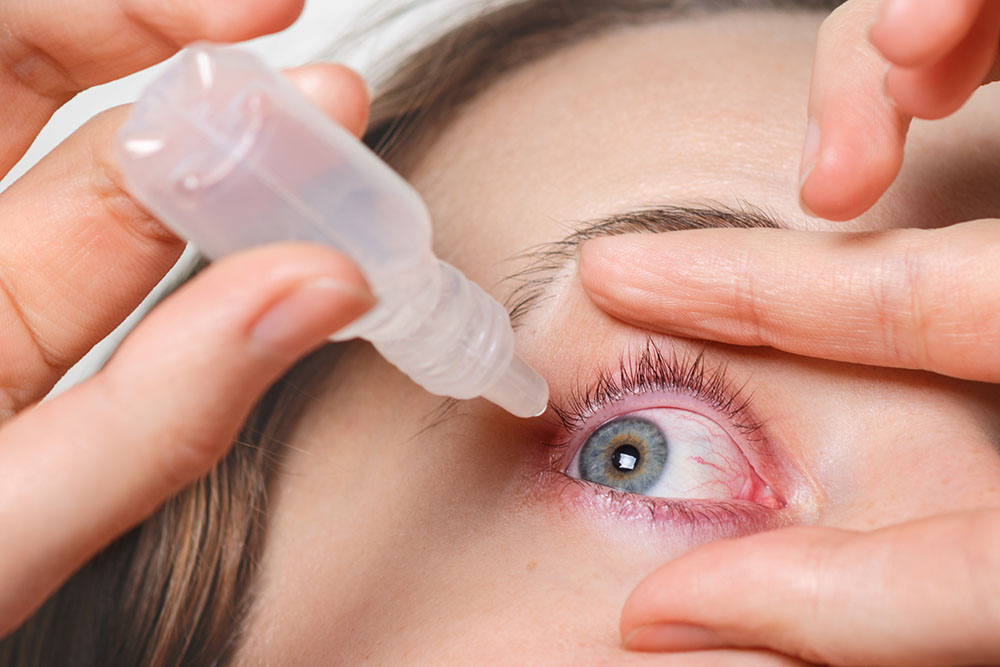 O que é a síndrome do olho seco