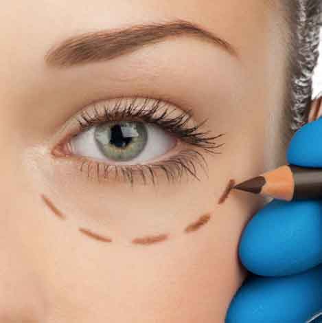 Procedimentos de Plástica Ocular Disponíveis em Taboão da Serra